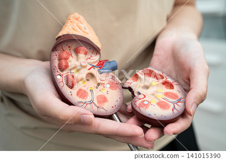 Chronic kidney disease, Asian woman with model for treatment urinary system, urology, Estimated glomerular filtration rate eGFR. Chronic kidney disease, Asian woman with model for treatment urinary system, urology, Estimated glomerular filtration rate eGFR. 141015390