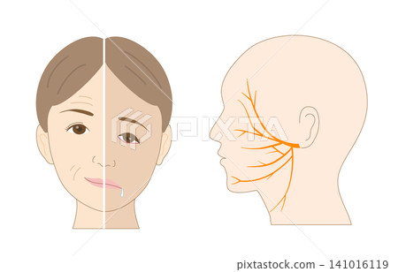 A comparative illustration of facial asymmetry caused by facial nerve paralysis and the facial nerve itself. A comparative illustration of facial asymmetry caused by facial nerve paralysis and the facial nerve itself. 141016119