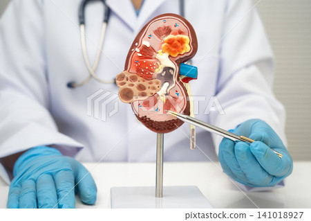 Chronic kidney disease, doctor with model for treatment urinary system, urology, Estimated glomerular filtration rate eGFR. 141018927