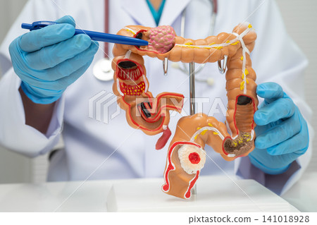 Colorectal cancer, doctor holding intestine colon human anatomy model. 141018928