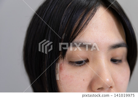 一名臉部受傷女子的臉 一名臉部受傷女子的臉 141019975