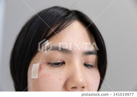 一名臉部受傷女子的臉 一名臉部受傷女子的臉 141019977