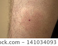 midge parasites 141034093