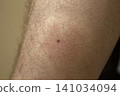 midge parasites 141034094
