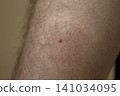 midge parasites 141034095