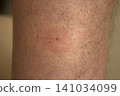midge parasites 141034099