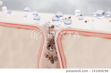 3d acne skin with clogged pore and water bubbles for acne treatment face wash. Salicylic acid cleanser, clear blue gel serum drops. Blackhead scrub, cosmetic skincare product render. 3D illustration 141069296