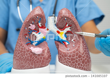 Pneumonia, lung cancer, Asian doctor with human lung model. Pneumonia, lung cancer, Asian doctor with human lung model. 141085107