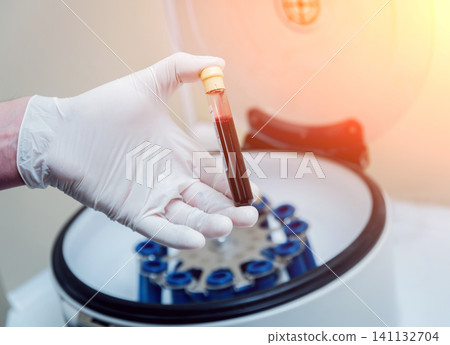 Platelet-Rich plasma preparation. Tube with blood in hands. Centrifuge. Platelet-Rich plasma preparation. Tube with blood in hands. Centrifuge. 141132704
