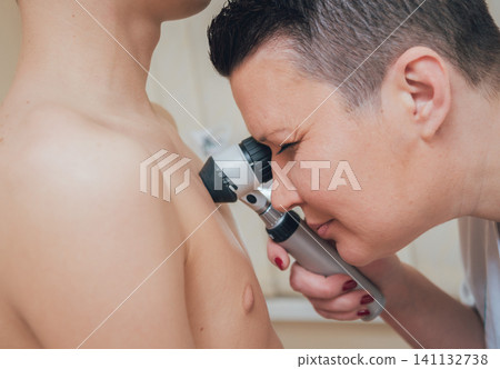 Dermatologist examines patient birthmark with dermatoscope. 141132738