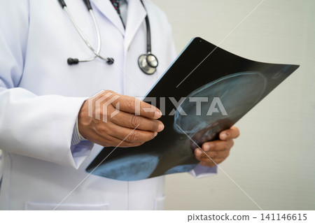 Doctor examining brain radiography xray film. Doctor examining brain radiography xray film. 141146615