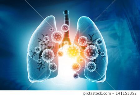 Viral lung infections, lung infection conept Viral lung infections, lung infection conept 141153352