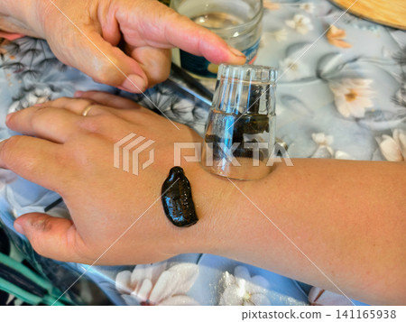 Person undergoing hirudotherapy, applying a leech on their arm for traditional medicine and alternative health treatment, with other leeches contained under a glass. Person undergoing hirudotherapy, applying a leech on their arm for traditional medicine and alternative health treatment, with other leeches contained under a glass. 141165938