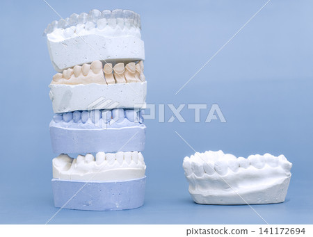 Stacked dental plaster casts with clear orthodontic aligner and single jaw model on blue background. Stacked dental plaster casts with clear orthodontic aligner and single jaw model on blue background. 141172694