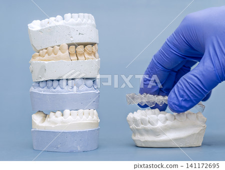 Orthodontist hand in blue glove holding clear aligner over dental plaster model. Invisible braces concept. Orthodontist hand in blue glove holding clear aligner over dental plaster model. Invisible braces concept. 141172695