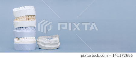 Orthodontic clear aligner on dental plaster model and stack of casts. Wide banner background with copy space for text. Orthodontic clear aligner on dental plaster model and stack of casts. Wide banner background with copy space for text. 141172696