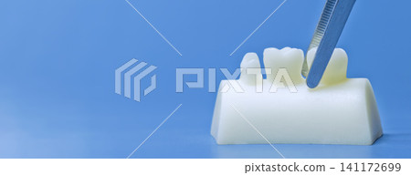 Dental extraction and prosthodontics concept. White tooth model and medical forceps on a clean blue background, panoramic layout. Dental extraction and prosthodontics concept. White tooth model and medical forceps on a clean blue background, panoramic layout. 141172699