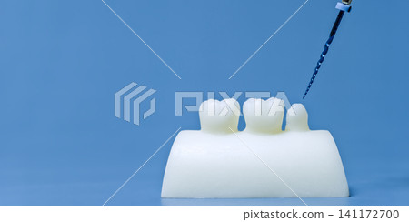 Endodontic file near a white tooth model. Root canal treatment banner with copy space on a blue background. Endodontic file near a white tooth model. Root canal treatment banner with copy space on a blue background. 141172700