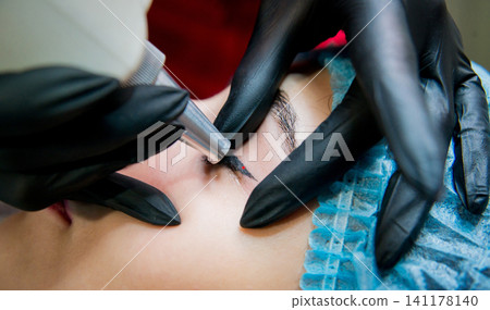 Laser correction Laser correction 141178140