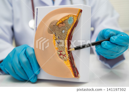 Doctor holding female breast human anatomy model. Doctor holding female breast human anatomy model. 141197302