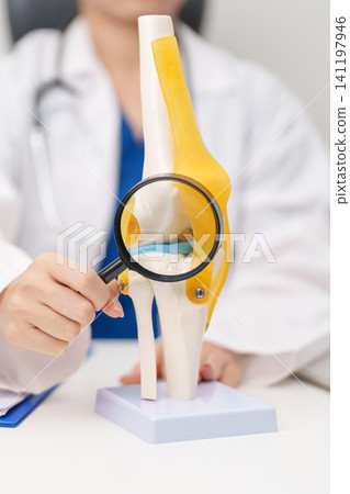 Doctor with Human Knee joint anatomy model. Osteoarthritis, Patellofemoral Pain Syndrome, Patellar Tendinitis, ACL, Anterior Cruciate Ligament, PCL, Posterior, MCL, Medial Collateral, LCL and Lateral Doctor with Human Knee joint anatomy model. Osteoarthritis, Patellofemoral Pain Syndrome, Patellar Tendinitis, ACL, Anterior Cruciate Ligament, PCL, Posterior, MCL, Medial Collateral, LCL and Lateral 141197946