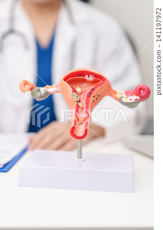 Doctor with Uterus and Ovaries anatomy model. Ovarian and Cervical cancer, Cervix disorder, Endometriosis, Hysterectomy, Uterine fibroids, Reproductive system, Pregnancy and health concept Doctor with Uterus and Ovaries anatomy model. Ovarian and Cervical cancer, Cervix disorder, Endometriosis, Hysterectomy, Uterine fibroids, Reproductive system, Pregnancy and health concept 141197972