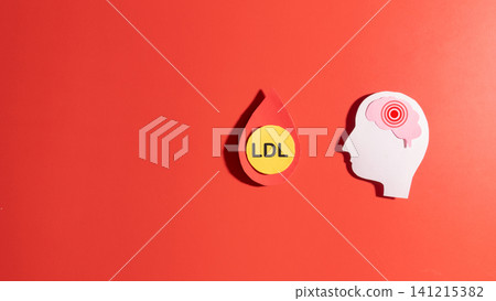 High LDL cholesterol increases the risk of stroke by boosting the risk of vascular disease. LDL cholesterol particles inside a blood droplet and human brain made from paper on red background. High LDL cholesterol increases the risk of stroke by boosting the risk of vascular disease. LDL cholesterol particles inside a blood droplet and human brain made from paper on red background. 141215382