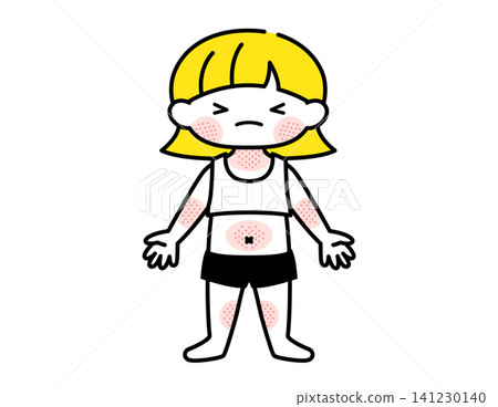 [Medical/Childcare] Illustration of a girl with eczema (atopic dermatitis) 141230140