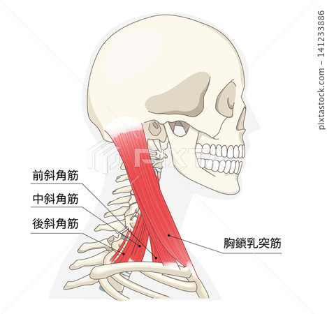 頸部肌肉側視圖解剖圖 141233886