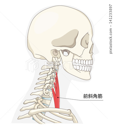 頸部肌肉側視圖解剖圖 141233897