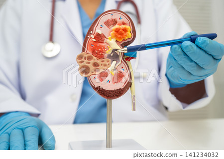 Chronic kidney disease, doctor with model for treatment urinary system, urology, Estimated glomerular filtration rate eGFR. 141234032