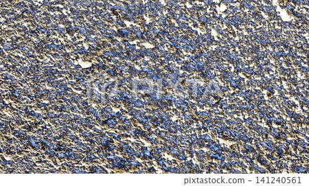 Abstract Background Abstract Background 141240561