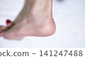 Dry skin on the feet, woman heel 141247488