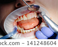 Dentist performing dental checkup cleaning teeth of patient wearing protective glasses 141248604