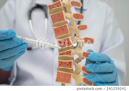 Doctor holding osteoporosis in back bone model for treatment medical. Doctor holding osteoporosis in back bone model for treatment medical. 141259141