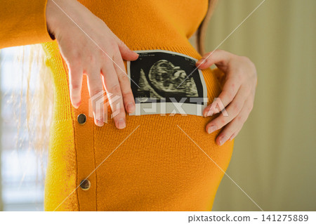Prenatal ultrasound screening. Pregnant woman hands holding sonogram picture of unborn baby inside big belly. Happy expectant mom with fetus usi scan image. Young mother enjoying pregnancy. Maternity Prenatal ultrasound screening. Pregnant woman hands holding sonogram picture of unborn baby inside big belly. Happy expectant mom with fetus usi scan image. Young mother enjoying pregnancy. Maternity 141275889