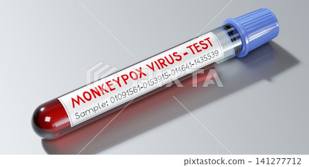 Monkey pox virus blood test vial - 3D illustration 141277712