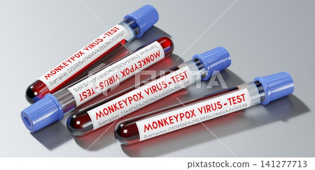 Monkey pox virus blood test vials - 3D illustration Monkey pox virus blood test vials - 3D illustration 141277713