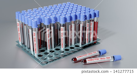Monkey pox virus blood test vials - 3D illustration Monkey pox virus blood test vials - 3D illustration 141277715