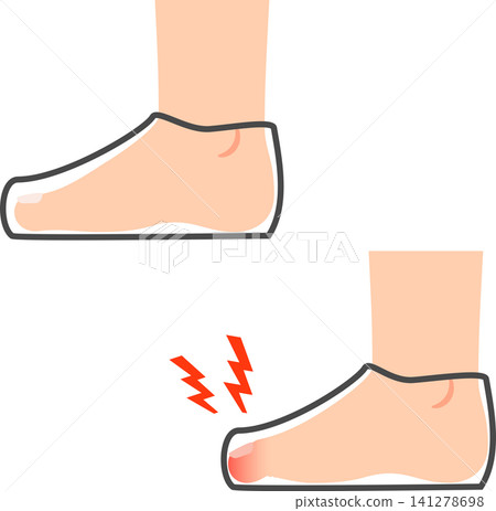 Feet with toes compressed inside shoes 141278698