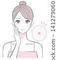 A woman suffering from acne on her face 141279060