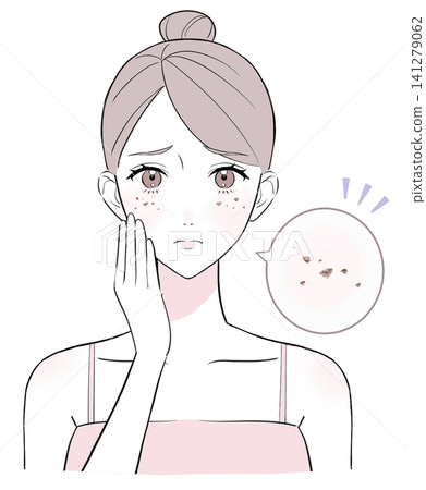 A woman suffering from facial blemishes A woman suffering from facial blemishes 141279062