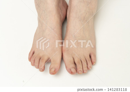 Foot problems of senior women Foot problems of senior women 141283118
