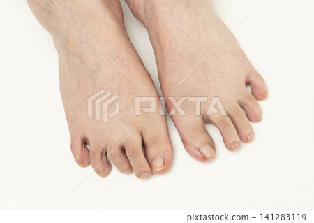 Foot problems of senior women Foot problems of senior women 141283119