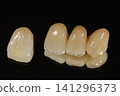 Would you like to have beautiful ceramic teeth? 141296373