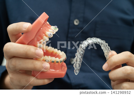 Man holding invisible aligner orthodontic retainer for dental teeth straightening. Man holding invisible aligner orthodontic retainer for dental teeth straightening. 141298932