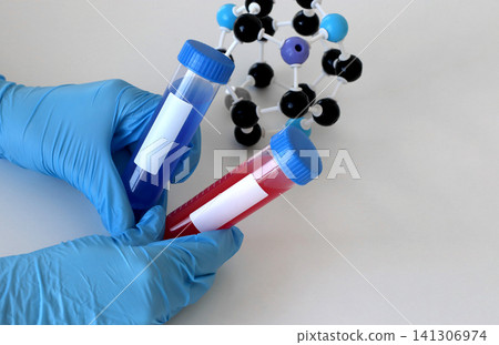 Gloved hands holding laboratory sample tubes with red and blue liquid for virus diagnostics, chemistry studies and scientific analysis. Medical healthcare concept for research activities. Hantavirus 141306974