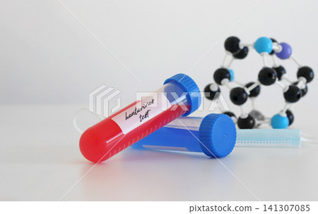 Blood sample tube labeled for hantavirus testing with molecular model and laboratory elements. Medical concept for infectious disease diagnostics, healthcare research and pathogen detection. Blood sample tube labeled for hantavirus testing with molecular model and laboratory elements. Medical concept for infectious disease diagnostics, healthcare research and pathogen detection. 141307085