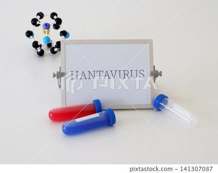 Medical laboratory composition with hantavirus information board, sample tubes and molecular model. Healthcare concept for infectious disease awareness, virus research and medical education. Medical laboratory composition with hantavirus information board, sample tubes and molecular model. Healthcare concept for infectious disease awareness, virus research and medical education. 141307087