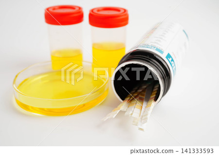 Urinalysis, urine cup with reagent strip pH paper test and comparison chart in laboratory. 141333593